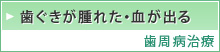 歯ぐきが腫れた・血が出る  歯周病治療